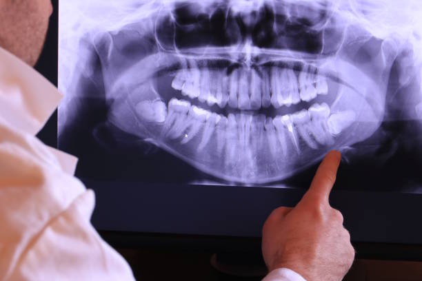 Best Emergency TMJ Treatment in Cold Spring, MN